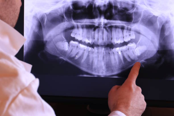 Best Emergency Root Canal Treatment in Riviera Beach, MD