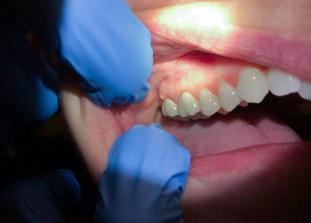 Best Emergency TMJ Treatment in Riviera Beach, MD
